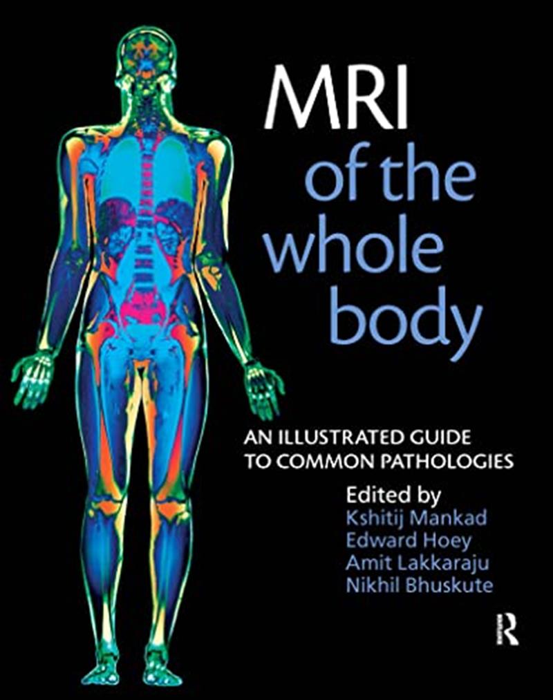MRI of the Whole Body: An Illustrated Guide for Common Pathologies by Nikhil Bhuskute, Edward Hoey, Amit Lakkaraju, Kshitij Mankad